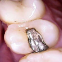 WIFI HD Dentálna kamera Z70