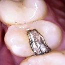 WIFI HD Dentálna kamera Z70